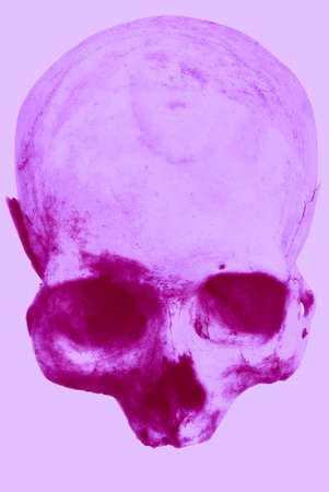 Real human skull on an isolated white background.の写真素材