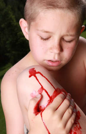 Ten years old boy holding his bloody injured kneeの写真素材
