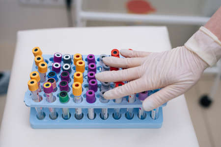 Doctor with the rubber gloves put his hand on the medical blood tube for blood collection. View from...