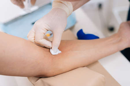 Nurse treats the patients arm with alcohol cotton wool before taking blood from vein, close-up. Preparation for blood test with by phlebotomist technician doctor. Concept of healthcare and medicine.の写真素材