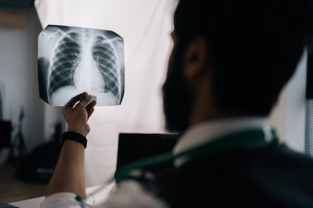Closeup back view of unrecognizable male doctor examining patient chest x-ray film lungs scan at...