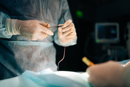 Close-up hands of unrecognizable professional surgeon in hospital doing invasive surgical interventions. Closeup of surgeon and nurse use medical instrument or equipment in dark operating room.の写真素材