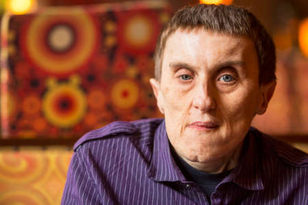 Portrait of disabled man with cerebral palsy in rehabilitation center.