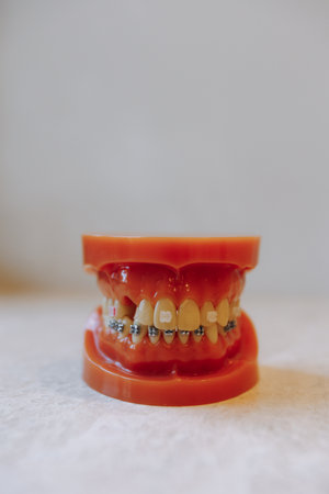A Comprehensive Dental Model that Includes Braces and Correct Teeth Alignment Features