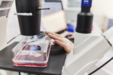 Doctor working with microscope. The scientist conducts research. Blood test.