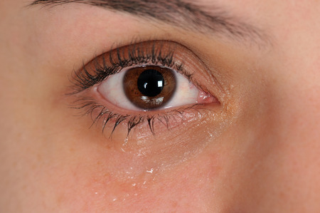 Close up of eye with tearsの写真素材