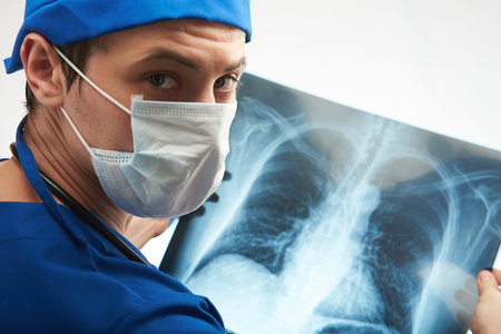 close up of doctor holding x-ray result of chest isolated on white