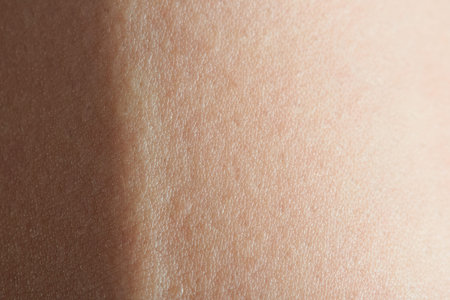 close up of blood vein under human skin