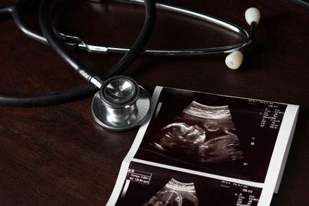 Close-up of stethoscope and ultrasound scan on wooden backgroundの写真素材
