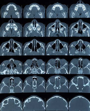 MRT scan of head picture in different level. 3d xray brain screen