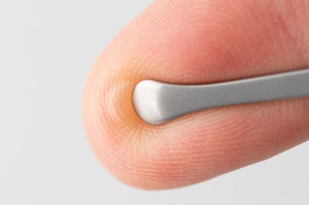 Close up of pinching blister on finger isolated on studio background