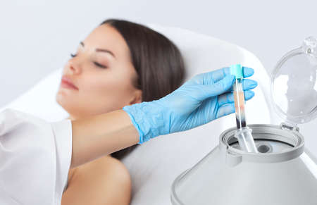 The blood tube is removed from the medical centrifuge for plasma lifting. Prp procedure.