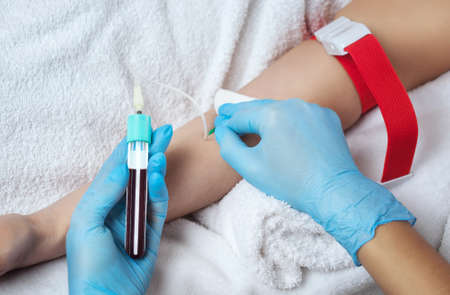 The blood tube is removed to the medical centrifuge for plasma lifting. Prp procedure and cosmetology concept.の写真素材