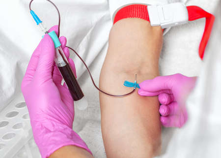 The doctor takes blood from a vein.  Prp procedure and cosmetology concept.の写真素材