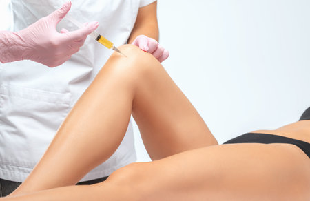 Doctor doing stem cell therapy on a patient's knee after the injury. Treating knee pain with platelet-rich plasma injection. Treatment of arthritis and osteoarthritis.Medical and cosmetology concept.の写真素材