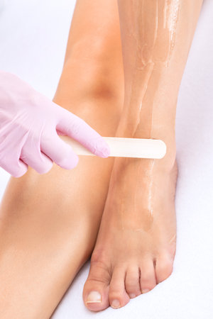 Elos epilation hair removal procedure on a woman's body. Beautician doing laser rejuvenation in a beauty salon. Removing unwanted body hair. Hardware ipl cosmetologyの写真素材