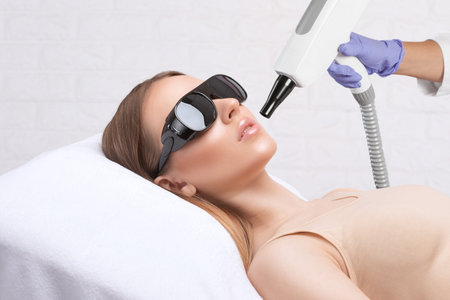 Cosmetologist doing carbon peeling procedure to beautiful blue-eyed girl in a beauty salon. hardware cosmetology treatment.の写真素材