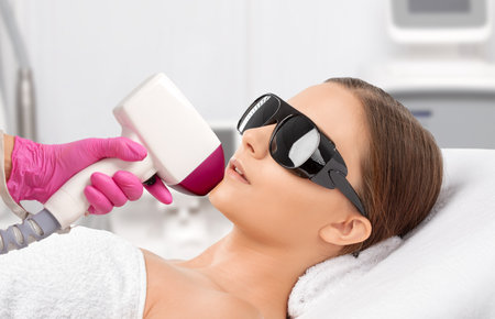 Elos epilation hair removal procedure on a woman's body. Beautician doing laser rejuvenation in a beauty salon. Removing unwanted body hair. Hardware ipl cosmetologyの写真素材