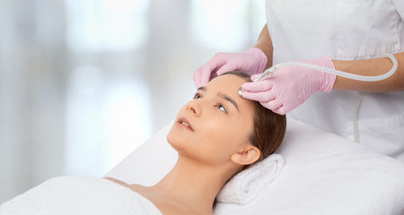 Procedure microdermabrasion on the face against acne and blackheads. Women's cosmetology in the beauty salon.の写真素材
