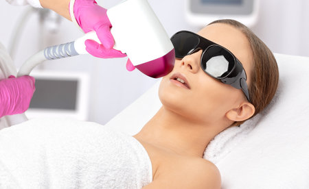Elos epilation hair removal procedure on a woman's body. Beautician doing laser rejuvenation in a beauty salon. Removing unwanted body hair. Hardware ipl cosmetologyの写真素材