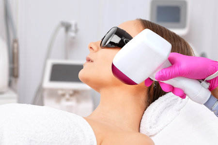 Elos epilation hair removal procedure on a woman's body. Beautician doing laser rejuvenation in a beauty salon. Removing unwanted body hair. Hardware ipl cosmetologyの写真素材