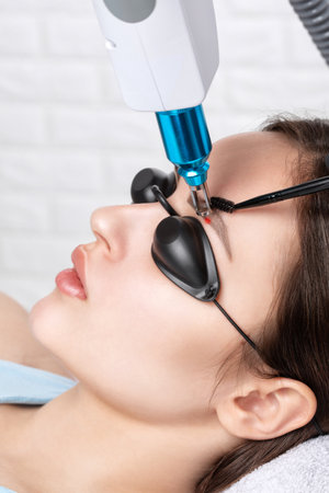 Removal of permanent makeup on the eyebrows.Carbon face peeling in a beauty salon. hardware cosmetology treatment.の写真素材