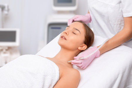Procedure microdermabrasion on the face and neck against acne and blackheads. Women's cosmetology in the beauty salon.の写真素材