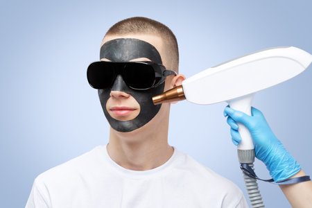 Beautician doing carbon peeling procedure to handsome guy in beauty salon. Hardware male cosmetology.の写真素材