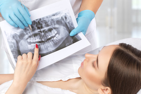 Doctor dentist shows the patient an x-ray of the upper and lower jaw of a young beautiful woman in a dental clinic. dental concept.の写真素材