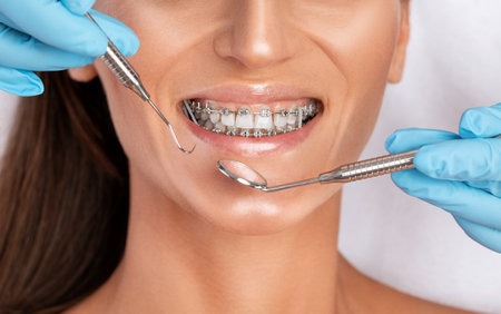Dentist examining the braces of the system on the teeth of a young beautiful woman in a dental clinic. Correction of malocclusion.の写真素材