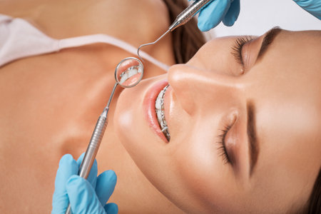 Dentist examining the braces of the system on the teeth of a young beautiful woman in a dental clinic. Correction of malocclusion.の写真素材