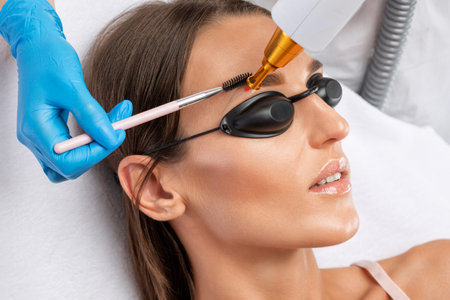 Removal of permanent makeup on the eyebrows of a woman.Carbon face peeling in a beauty salon. hardware cosmetology treatment.の写真素材
