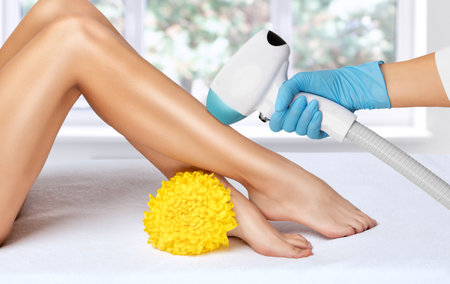 Elos epilation, hair removal procedure on a woman's body. Beautician doing laser rejuvenation in a beauty salon. Removing unwanted body hair. hardware ipl cosmetologyの写真素材