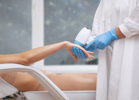 Elos epilation hair removal procedure on a woman's body. Beautician doing laser rejuvenation in a beauty salon. Removing unwanted body hair. Hardware ipl cosmetologyの写真素材