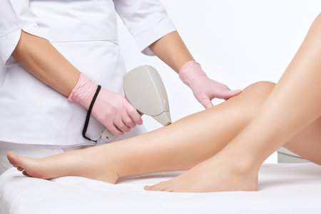 Elos epilation, hair removal procedure on a woman's body. Beautician doing laser rejuvenation in a beauty salon. Removing unwanted body hair. hardware ipl cosmetologyの写真素材