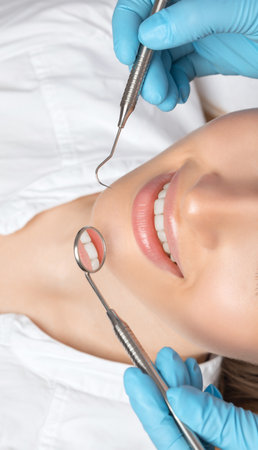 A dentist doctor treats caries on a tooth of a young beautiful woman in a dental clinic. Tooth filling.の写真素材