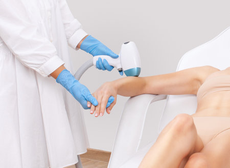 Elos epilation hair removal procedure on a woman's body. Beautician doing laser rejuvenation in a beauty salon. Removing unwanted body hair. Hardware ipl cosmetologyの写真素材