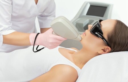 Elos epilation hair removal procedure on a woman's body. Beautician doing laser rejuvenation in a beauty salon. Removing unwanted body hair. Hardware ipl cosmetologyの写真素材