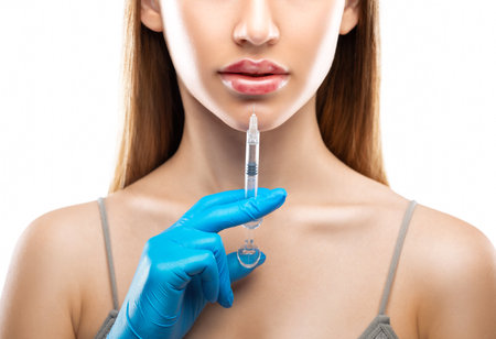 Injections for lips augmentation anti wrinkle injections on the face of a beautiful woman. Female aesthetic cosmetology in a beauty salon. Hematomas after lip contouring.の写真素材
