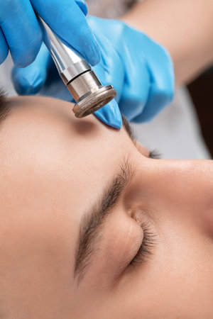 A cosmetologist is making the procedure Microdermabrasion of the facial skin in a beauty salon. Cosmetology for men and professional skincare.の写真素材