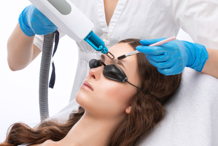 Removal of permanent makeup on the eyebrows of a woman.Carbon face peeling in a beauty salon. hardware cosmetology treatment.の写真素材