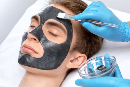 Beautician doing carbon peeling procedure to handsome guy in beauty salon. Hardware male cosmetology.の写真素材