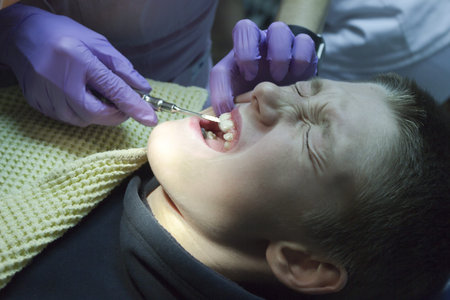 A young boy getting his teeth examined and cleanedの写真素材