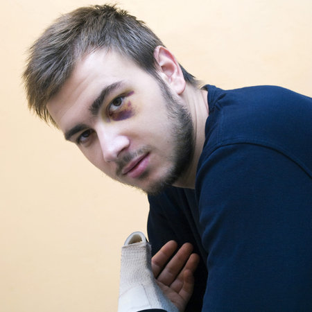 Handsome young man with a shiner. Portrait