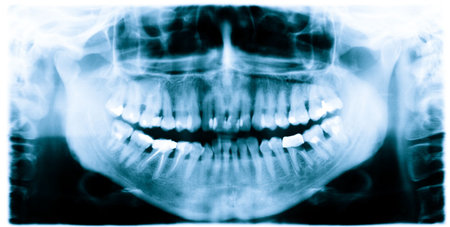 Teeth and jaw  dental  x-ray image