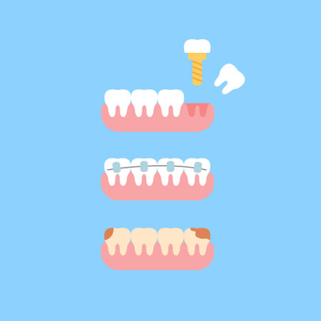 Set of teethのイラスト素材