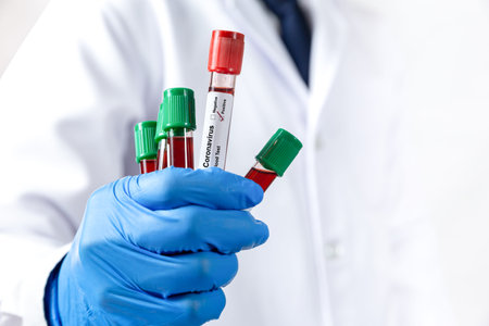 Doctor hand holding blood tube test or sample in medical laboratory for diagnosis virus.Coronavirus...