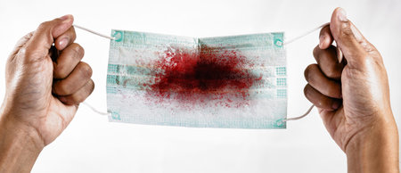 Hand holding mask with red blood stains from cough and sneeze.tuberculosis problem about...