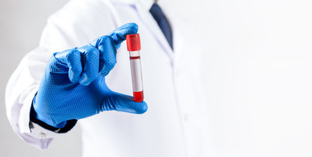 Doctor hand holding blood tube test or sample in medical laboratory for diagnosis virus.Coronavirus...