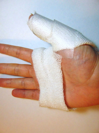 hand bandageの写真素材